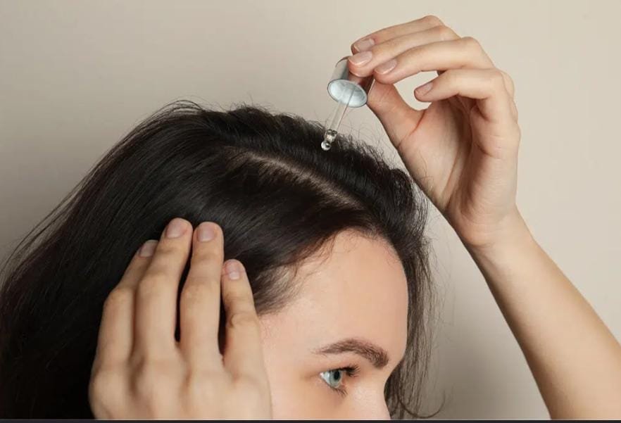 do bald people get dandruff